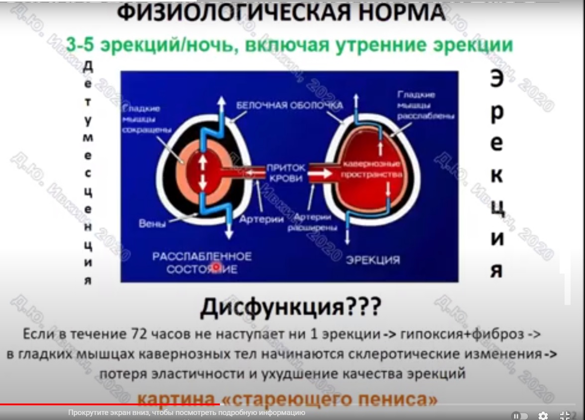 пенис.jpg